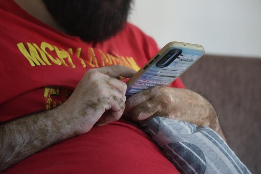 Türkiye günlerce onu konuşmuştu: Deprem sonrası hayattan kopan Barış Özbay'ın acı hikayesi: 3 aylık tedavinin ardından yine eve kapanıp telefon bağımlısı oldu!