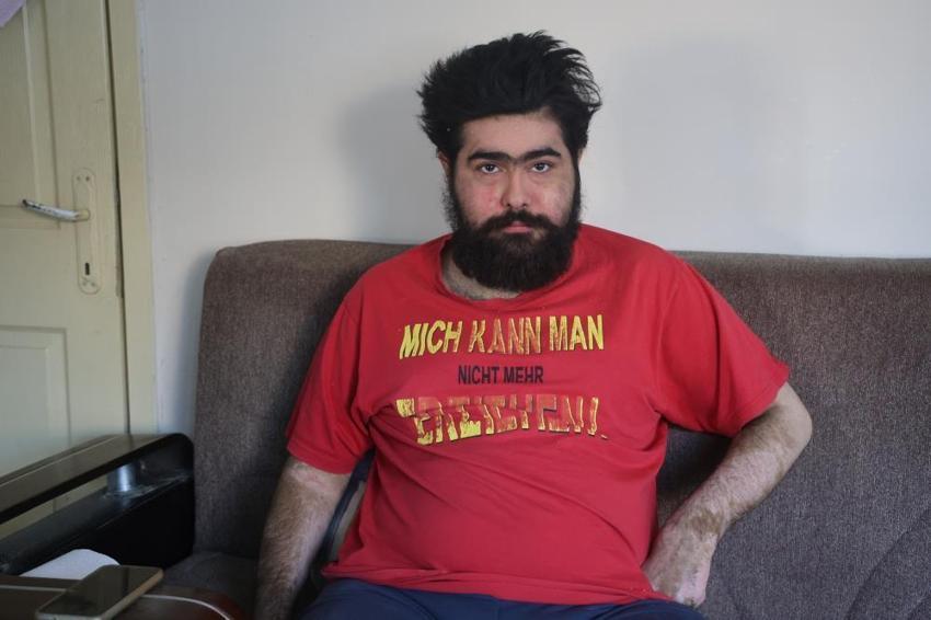 Türkiye günlerce onu konuşmuştu: Deprem sonrası hayattan kopan Barış Özbay'ın acı hikayesi: 3 aylık tedavinin ardından yine eve kapanıp telefon bağımlısı oldu!