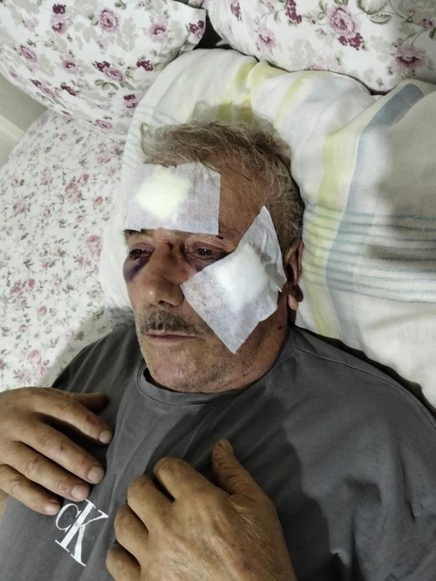 Kocaeli'de bir inek yüzünden başlayan tartışma kanlı bitti! Öğretmene muştalı saldırı suçlaması